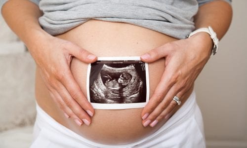 Pregnant woman holds an ultrasound scan against her belly